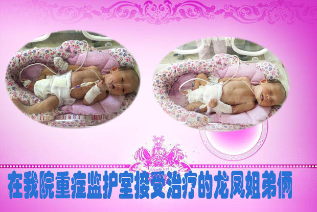 接受治疗的龙凤姐弟俩.jpg